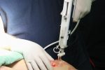دستیابی محققان گیلانی به فوق پیشرفته‌ترین درمان سوختگی جهان